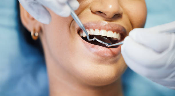 Best Emergency Dentist for Knocked-Out Tooth in Price, UT